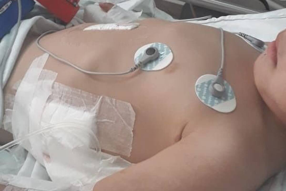 El niño de 3 años debió ser operado de urgencia tras ser atacado por el animal