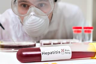 Alarma en Neuquén por un posible caso de hepatitis aguda grave de origen desconocido