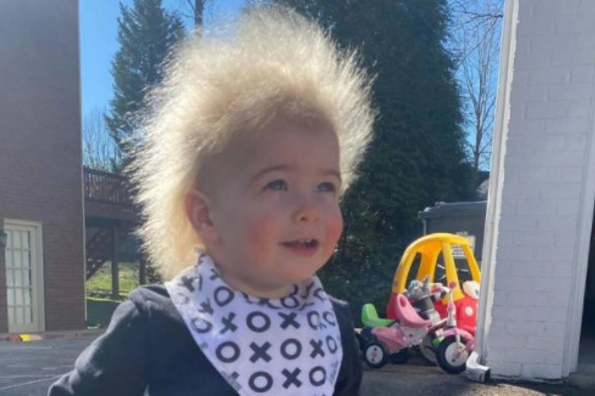 El niño padece una condición que hace que su cabello no pueda ser peinado. Fuente: Instagram