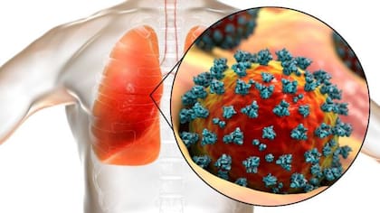 El nuevo estudio muestra una forma potencial de desarrollar nuevos tratamientos dirigidos a los pulmones en lugar del sistema inmunológico