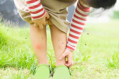 El olor a ácido láctico de los pies atrae a los mosquitos; es diferente en cada persona; las piernas funcionan como chimeneas del olor