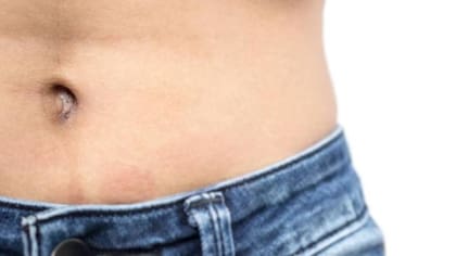 El ombligo es una cicatriz en la mitad del estómago (Foto: iStock)