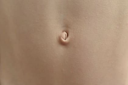 El ombligo es una cicatriz que nos quedó luego de que al nacer nos cortaran el cordón umbilical