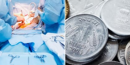 El paciente, según el testimonio de los doctores, comía monedas por placer (Foto:Istock)