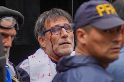 El Padre Paco, herido (foto de Nicolás Hernández)