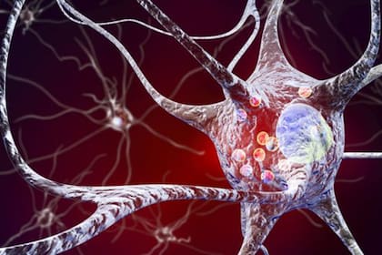 El Parkinson afecta a todos los pacientes de forma distinta