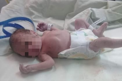 El pequeño bebé fue encontrado sin signos vitales adentro de una bolsa de nylon pero la Policía le salvó la vida.