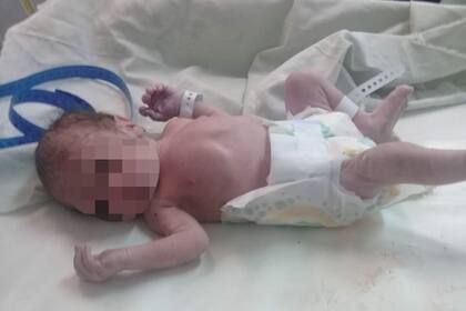 El pequeño bebé fue encontrado sin signos vitales adentro de una bolsa de nylon pero la Policía le salvó la vida.