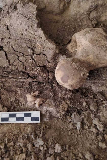 El pequeño tumor llamó la atención de las arqueólogas que trabajan en el Proyecto Amarna y en un primer momento lo confundieron con un feto
