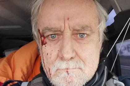 El periodista Guillaume Briquet fue atacado por las fuerzas rusas