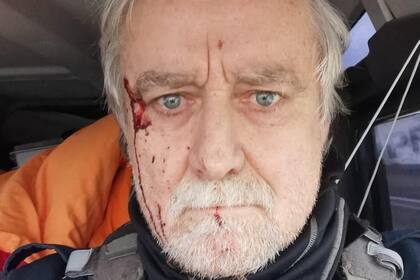 El periodista Guillaume Briquet fue atacado por las fuerzas rusas