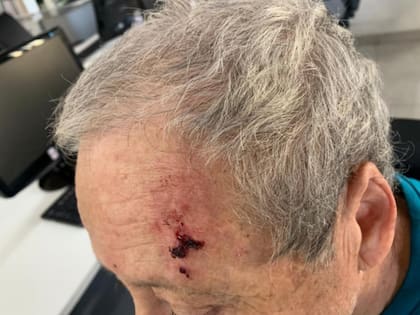 El periodista, herido en la cabeza