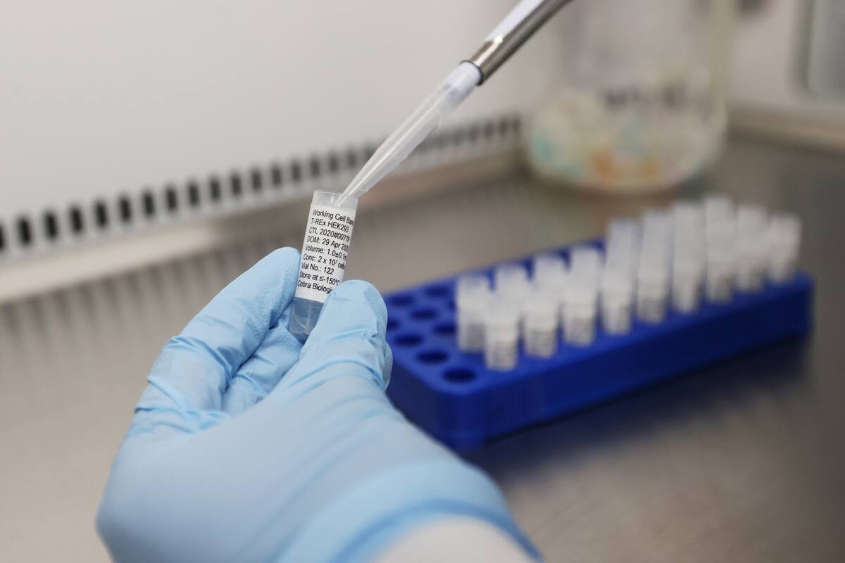 El plan de la Unión Europea es conseguir vacunas para el coronavirus cuyo costo no supere los 40 dólares