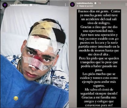 El rapero Kaleb Di Masi colisionó contra un patrullero y se investiga si corría picadas