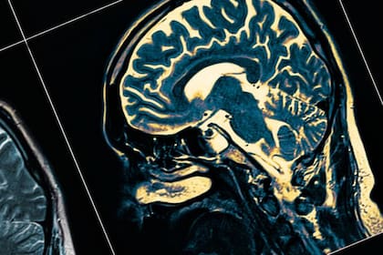 El registro de la actividad cerebral se hizo a través de una electroencefalografía