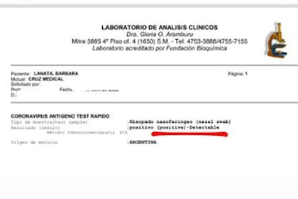El resultado del test Covid que Bárbara Lanata compartió en Instagram