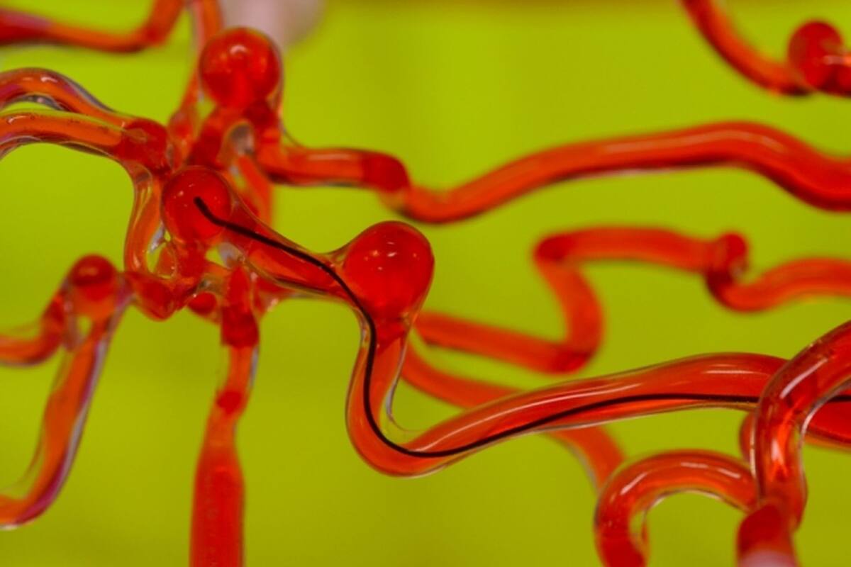 El robot tiene la forma de un cable y se controla por magnetismo para poder avanzar por el cerebro sin dañarlo; incluso puede llevar un láser diminuto para quemar un coágulo