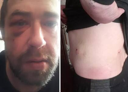 El rostro amoratado de Ivan Skyba y sus heridas de bala en el costado