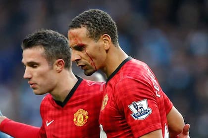 El rostro de Ferdinand, ensangrentado