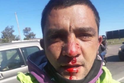 El rostro del inspector municipal tras ser golpeado por los agresores