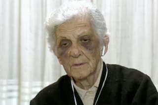 Una jubilada de 85 años fue asaltada y golpeada brutalmente