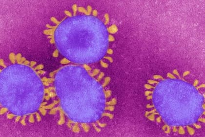 El SARS-CoV-2 ha sido catalogado como un virus con potencial endémico por la OMS