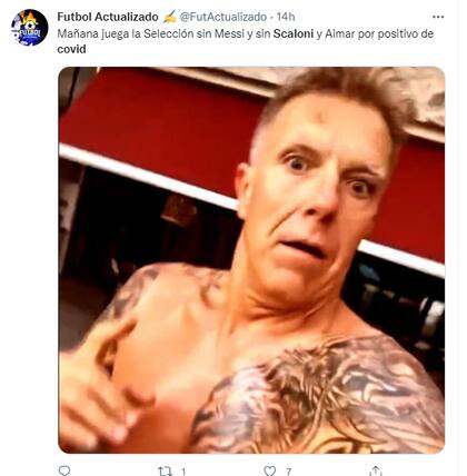 El seleccionado tiene tres bajas importantes para este partido clave ante Chile