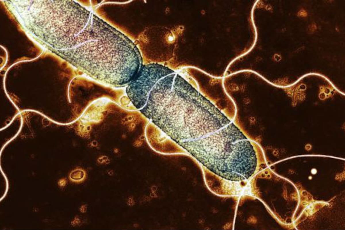 El SIBO es un crecimiento anómalo de las bacterias en el intestino delgado