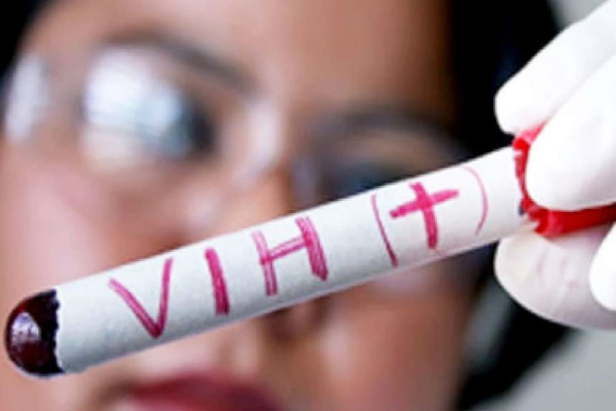 El sida afecta a 120.000 argentinos