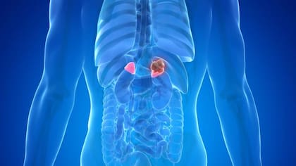 El síndrome de Cushing puede causar afectaciones al cuerpo que pueden ser confundidas con otras enfermedades.
