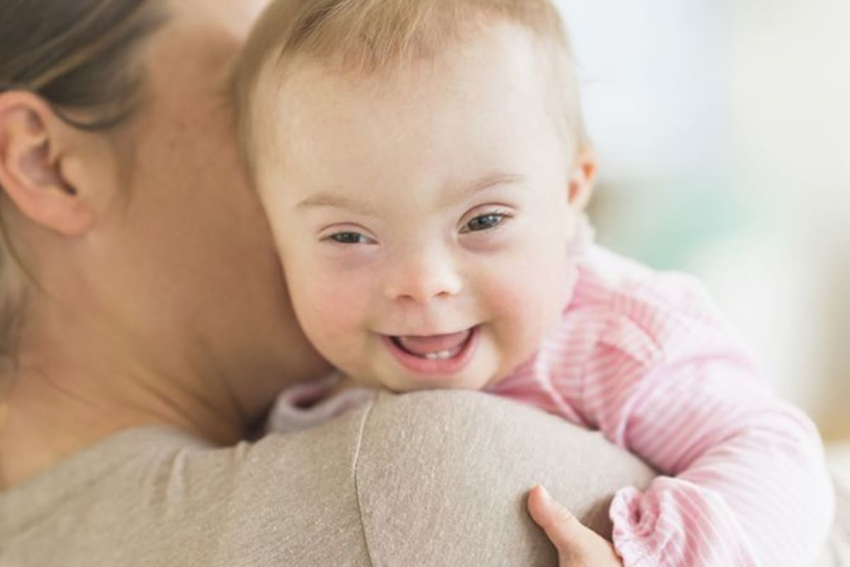 El síndrome de Down es un trastorno genético en el que la persona tiene un cromosoma extra
