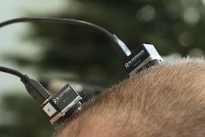 Cómo los implantes cerebrales experimentales transformaron la vida y el habla de un paciente