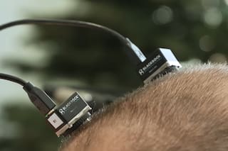 Cómo los implantes cerebrales experimentales transformaron la vida y el habla de un paciente