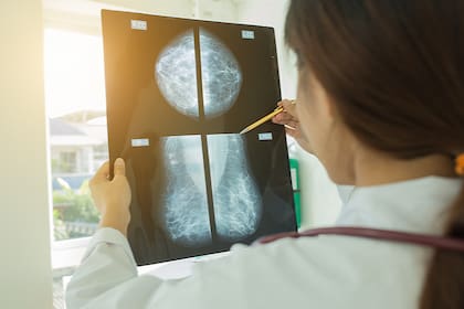 El sistema logró una mejor precisión en la detección temprana del cáncer de mama comparado con los métodos tradicionales de prevención
