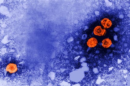 El sistema sanitario activó medidas preventivas tras detectar síntomas compatibles en viajeros procedentes de zonas afectadas