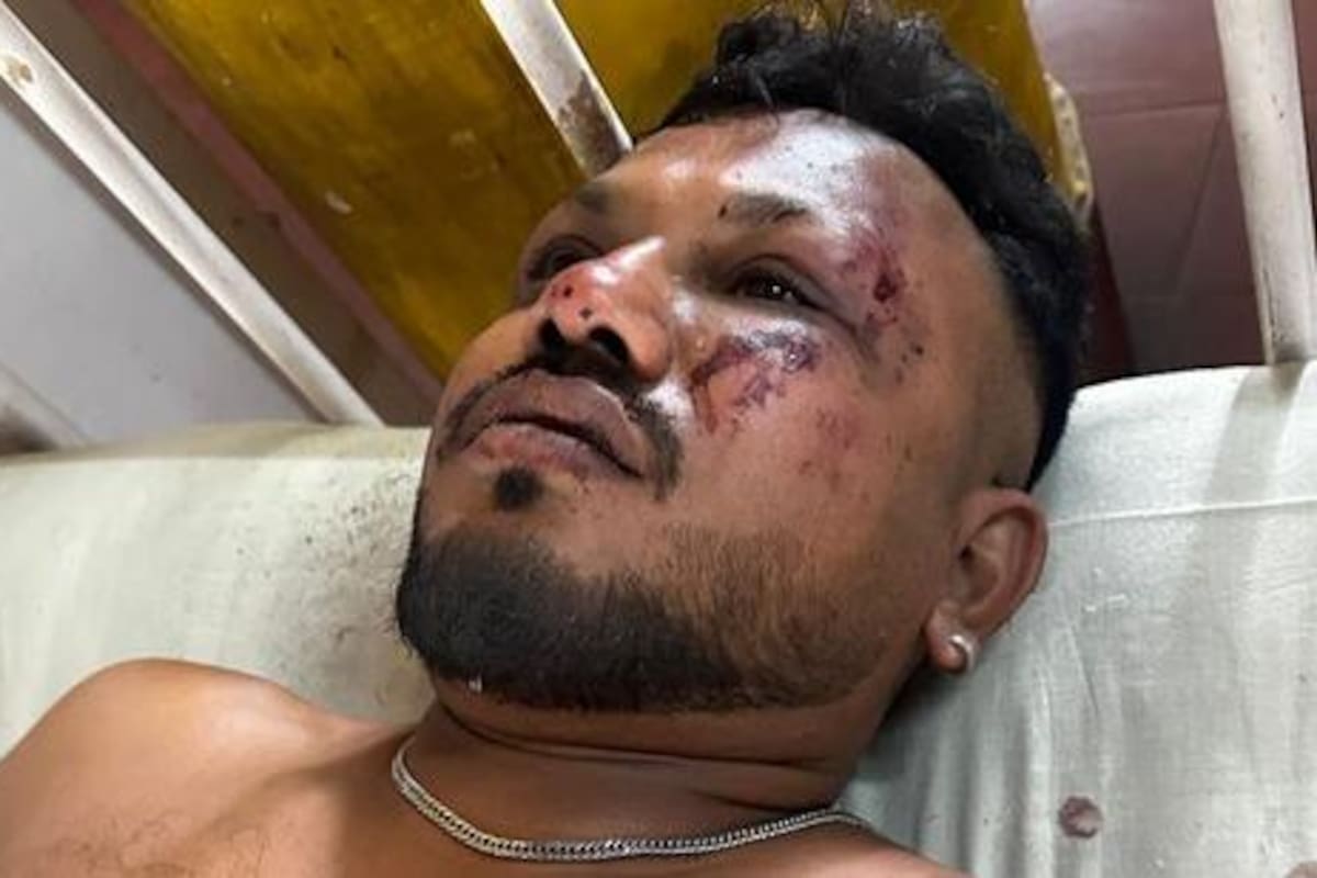 El sobreviviente del accidente de Air India.