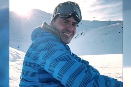 El sujeto escogió la clínica de estética tras investigar lugares para injerto de pelo en España (Foto: Tomada de video de Y Ahora Sonsoles)