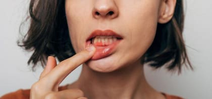 El té blanco también ayuda a mantener una buena salud bucal, por sus propiedades antibacterianas