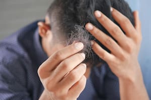 El té milagroso que evita la caída del pelo