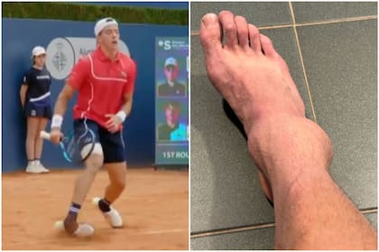 El tenista francés Arthur Cazaux sufrió una severa lesión en el tobillo derecho, durante un partido del ATP de Barcelona