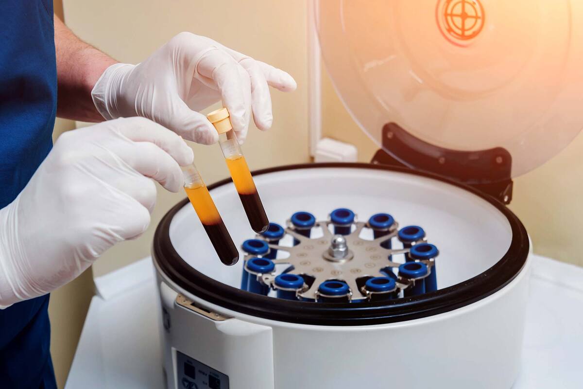 El total de casos para un día fue de 316, récord en el país