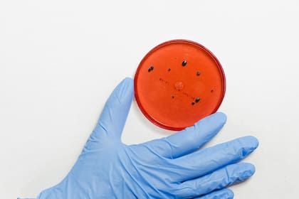 El virus se mantuvo vigente a pesar del paso del tiempo