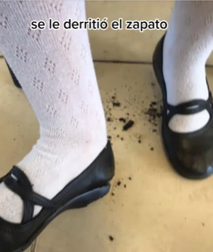 El zapato se cayó en pedazos