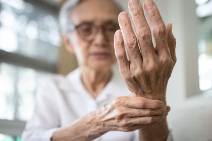 La osteoartritis se observa con mayor frecuencia entre las personas mayores de 50 años, en particular las mujeres, según detallan los especialistas