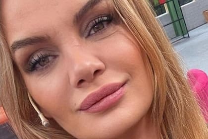 Eliana Guercio se hizo un tratamiento estético y tuvo “reacciones adversas”