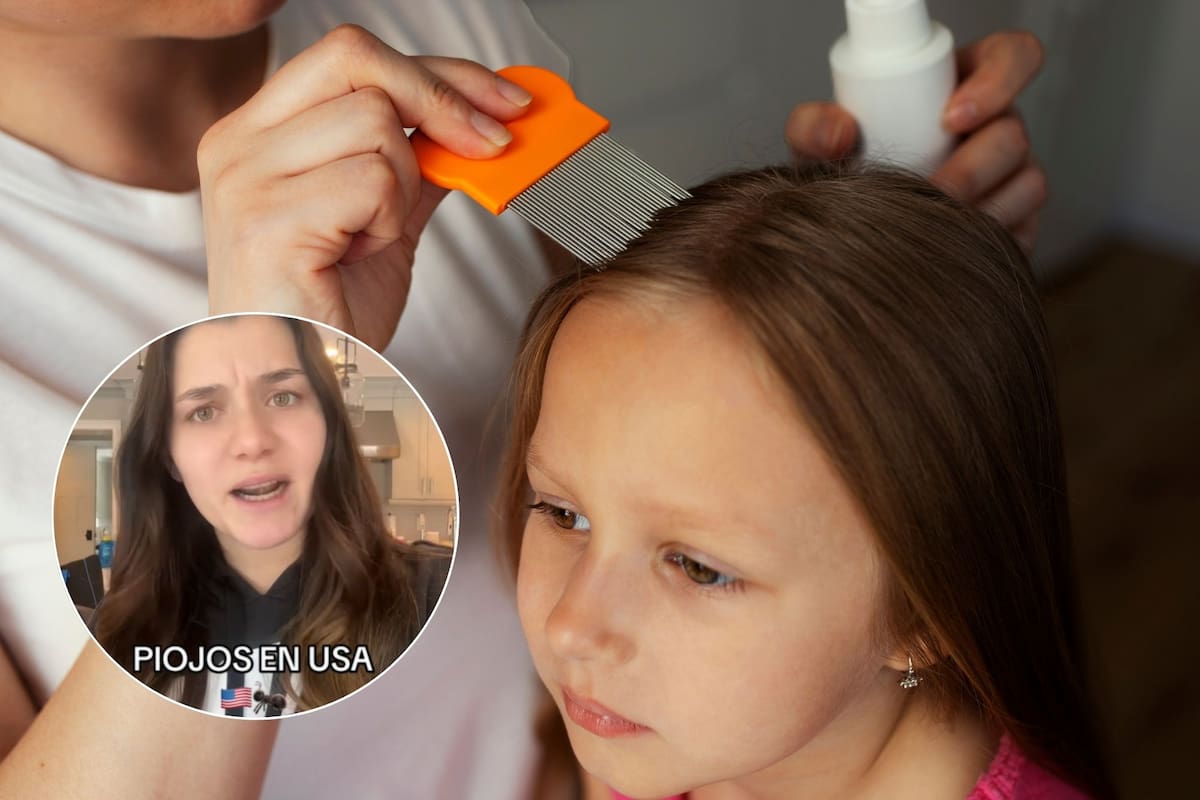 Eliminar los pequeños parásitos del cuero cabelludo de los niños es una preocupación común entre los padres, sobre todo cuando los tratamientos caseros no resultan efectivos