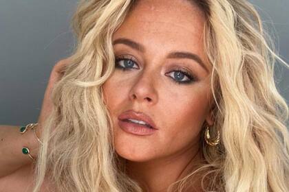 Emily Atack pasó por una serie de cambios físicos que la hacen lucir diferente a cuando comenzó su carrera