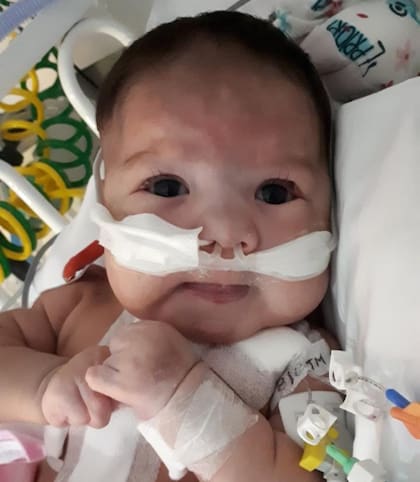 Emma superó la operación a corazón abierto.
