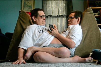 Ronnie y Donnie Galyon, de Ohio, estaban unidos por su abdomen. En 2014 lograron el récord Guinness como los siameses más longevos de la historia.
