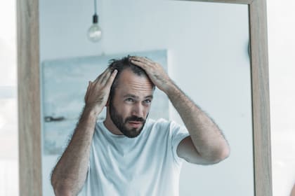 En algún momento, la mayoría de las personas experimenta caída del cabello y esto suele afectar su bienestar psicológico
